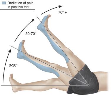Lower Extremity Exam 的图像结果