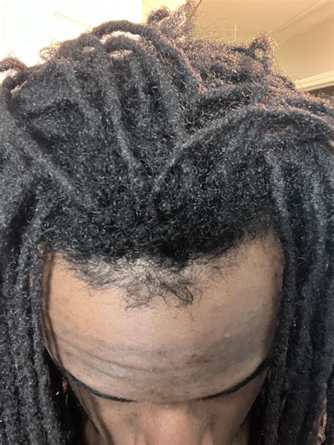 Taper With Dreads