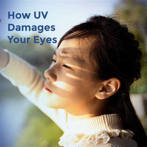 How UV Damages Your Eyes | EyeCarePro | Marketing