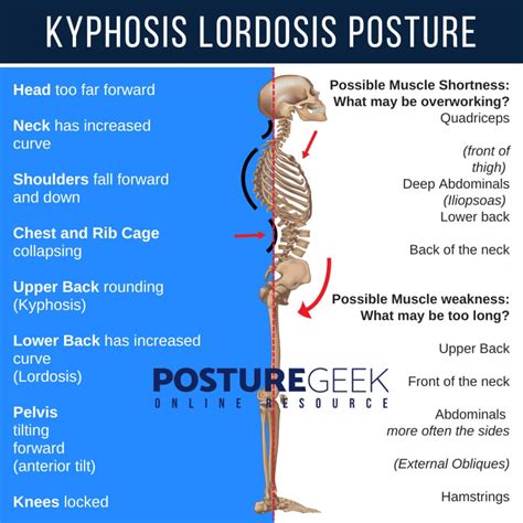 Lordosis Vs Kyphosis Spine Anatomy Matthew D. Hepler, M.D.
