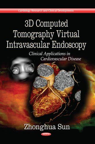 Buy 3D Computed Tomography Virtual Intravascular Endoscopy: Clinical ...