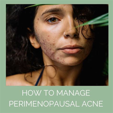 Acne in Your 40s - Could be Perimenopause - Odylique