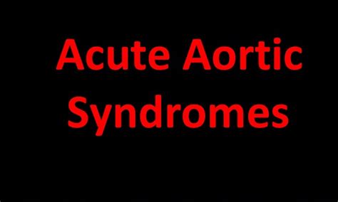 New Canadian guideline for diagnosing acute aortic syndrome released
