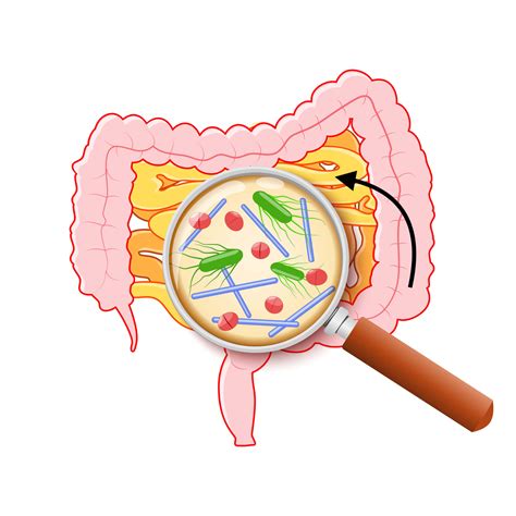 Headaches, bloating, diarrhea with L. reuteri - Dr. William Davis