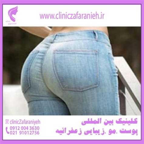 چگونه باسن برزیلی داشته باشیم؟ - کلینیک بین المللی پوست و مو زیبایی ...