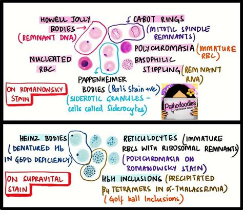 RBC - Inclusion Bodies