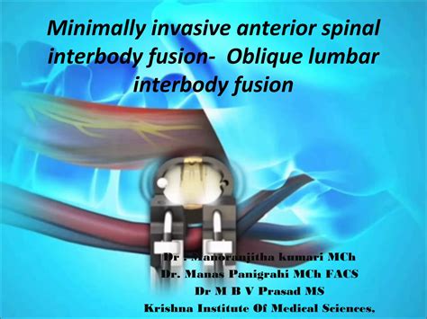 OLIF-oblique lumbar interbody fusion | PPT