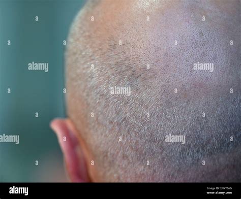 Spreetal, Germany. 22nd Feb, 2023. A man with a half bald head. Credit ...