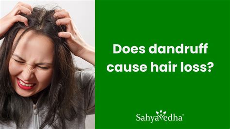 Does dandruff cause hair loss? – Sahyavedha