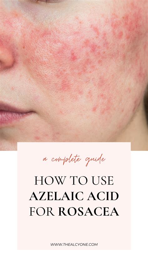 How To Use Azelaic Acid
