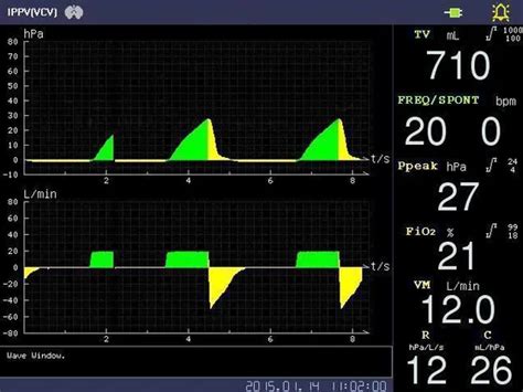 Image result for Machine Check PMB Anaesthesia