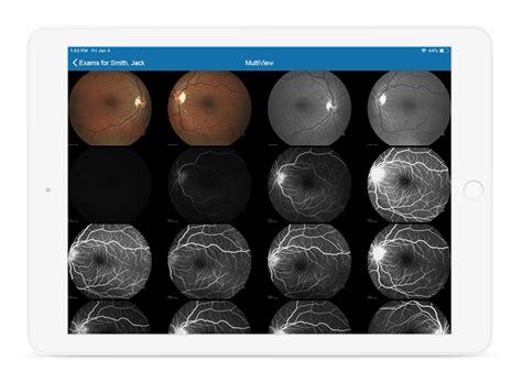 Image result for Eyefinity Tutorial