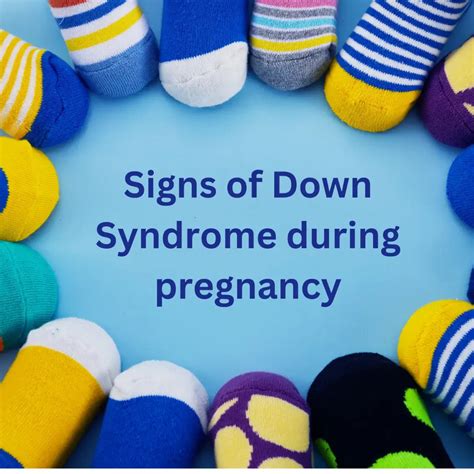 Common Treatments for Down Syndrome ( Guide )