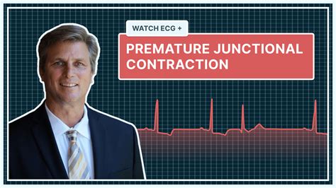 QALY | What a Premature Junctional Contraction (PJC) Looks Like on Your ...