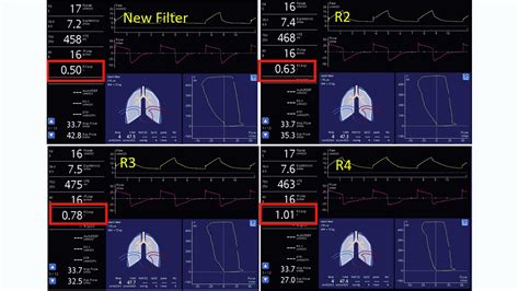 How to recognize increases in expiratory filter resistance | Hamilton Medical