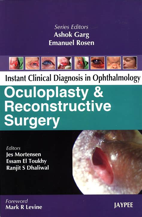 Buy OCULOPLASTY & RECONSTRUCTIVE SURGERY INSTANT CLINICAL DIAGNOSIS IN ...