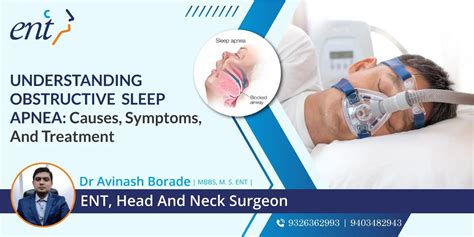 Image result for Obstructive Sleep Apnea