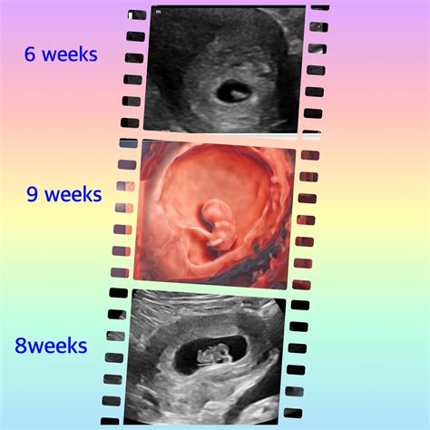 Ultrasound 3D 4D 5D HD baby ultrasound imaging. Gender Ultrasound ...