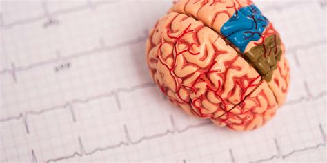 Image result for ADHD Brain Scan vs Normal