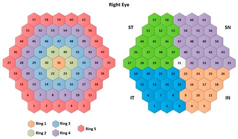 Empirical Mode Decomposition-Based Filter Applied to Multifocal ...