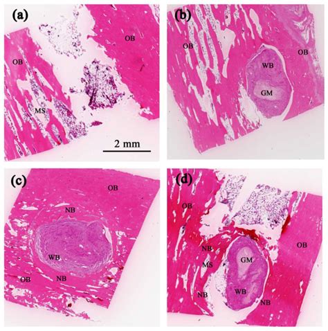 In Vivo Investigation into Effectiveness of Fe3O4/PLLA Nanofibers for ...
