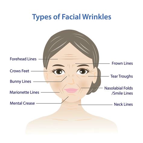 Types of facial wrinkles vector illustration isolated on white ...
