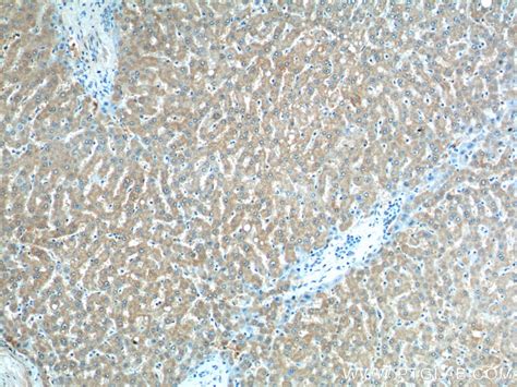CLTB antibody (66270-1-Ig) | Proteintech