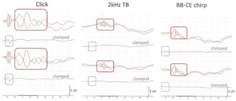 Use of an Extra-Tympanic Membrane Electrode to Record Cochlear ...