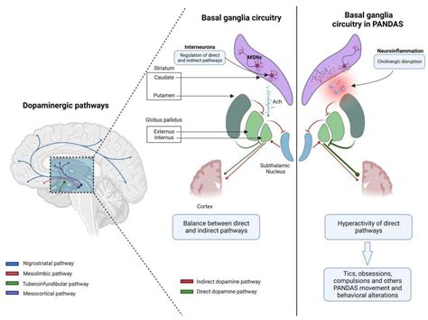 Pediatric Autoimmune Neuropsychiatric Disorders Associated with Streptococcal Infections (PANDAS ...