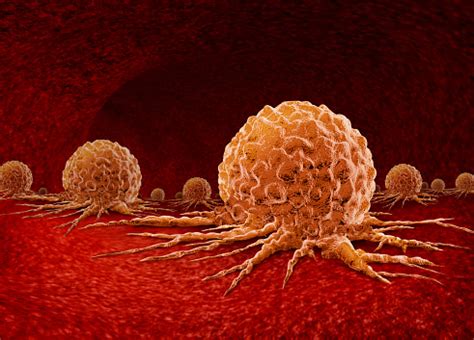 Image result for Cancer Detection Using Graph CNN