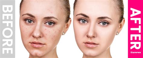 Image result for Hunvva Microcurrent Tutorials