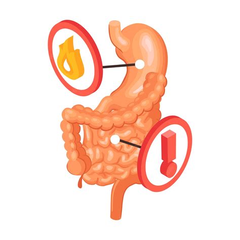 Gastrointestinal Stock Illustrations – 13,506 Gastrointestinal - Clip Art Library