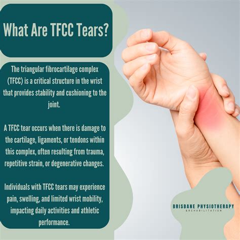 TFCC Tear - Triangular Fibrocartilage Complex - Symptoms, Treatment ...