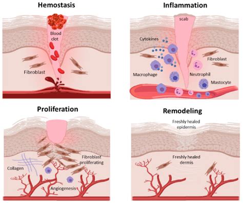 Angiogenin and Copper Crossing in Wound Healing
