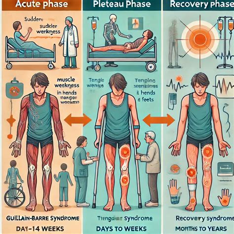 Guillain-Barré Syndrome (GBS) – Causes, Symptoms, Diagnosis, and Treatment