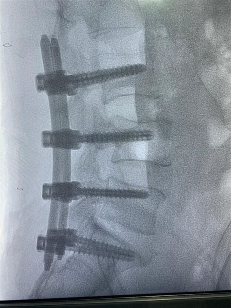 International Neurosurgery Hospital Rankings: Dr. Rao's