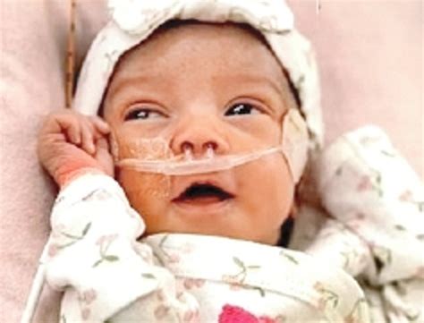 First Successful Brain Surgery Of A Baby Girl In The Womb, The Team Of ...