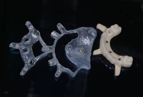 Image result for Stackable Guide Dailymotion