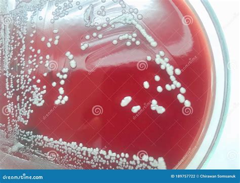 White colony on blood agar stock photo. Image of experiment - 189757722