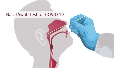 COVID-19 nasal swab test may not be best for those who've had sinus surgery