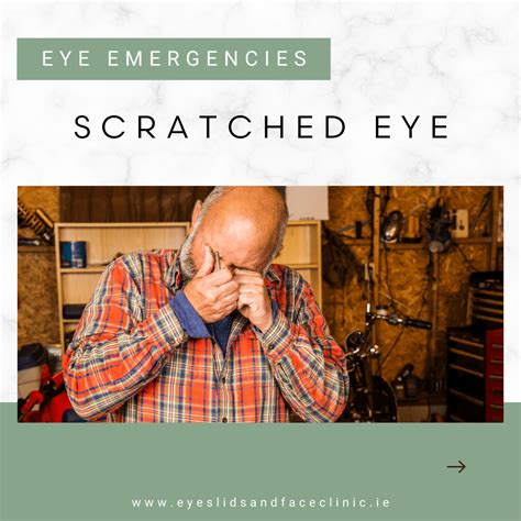 Scratched Eye Discharge at Gerald Fernandez blog