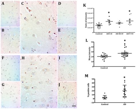 Perinuclear Lamin A and Nucleoplasmic Lamin B2 Characterize Two Types ...