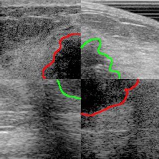 Checkerboard 2X2 Pattern 的图像结果