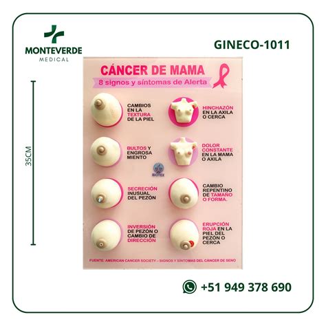 Tablero para Prevención de Cáncer de Mama Signos y Síntomas