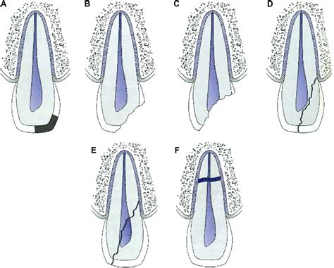 Image result for Graphical Abstract Examples of a Process