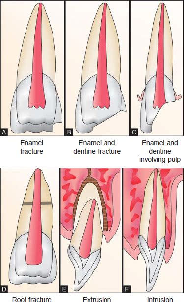 Image result for Graphical Abstract Examples of a Process