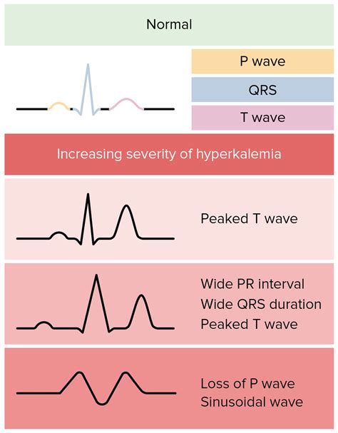 Hyperkalemia | Concise Medical Knowledge