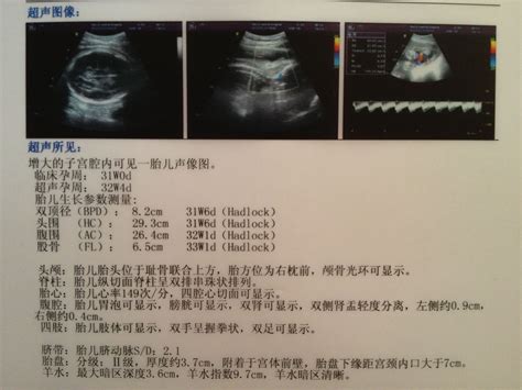 月子中心护工给待产孕妇量肚子维度高清图片下载-正版图片501694401-摄图网