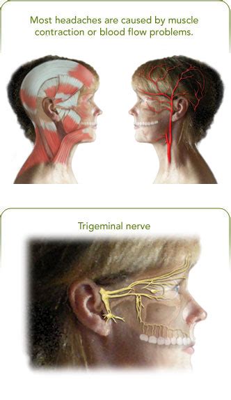 Managing Your Headaches