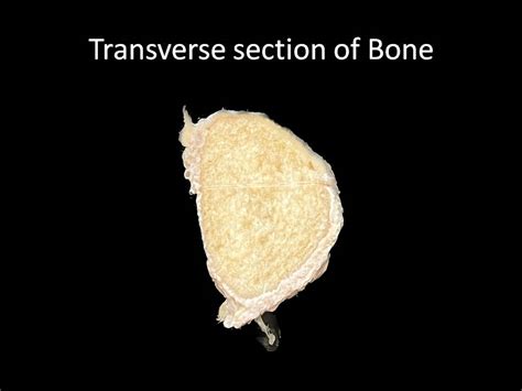 Transverse Section of Bone | NAMO Medical Education & Research Institute